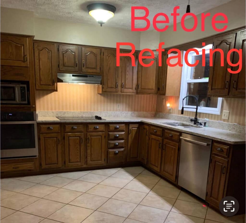 Before Refacing